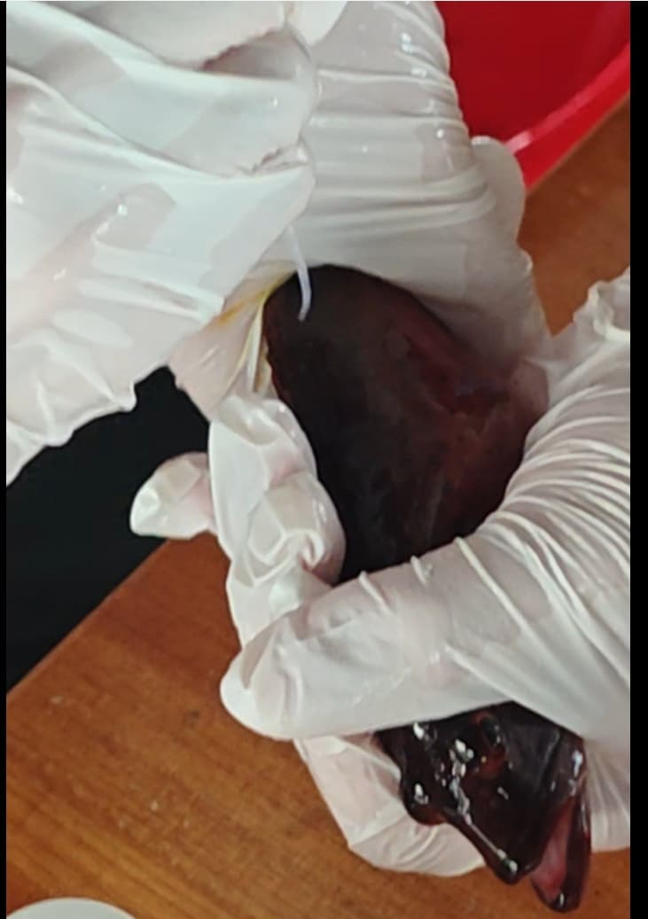 Sealing the needle site with tissue adhesive